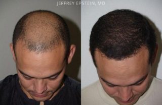 Best hair specialist in Lahore Pakistan | hair doctor in Lahore for hair  loss
