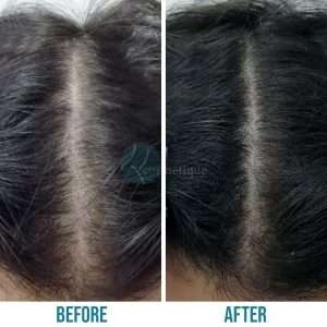 Best hair Specialist in Lahore, hair clinic in lahore, doctor for hair loss, best treatment for hair loss