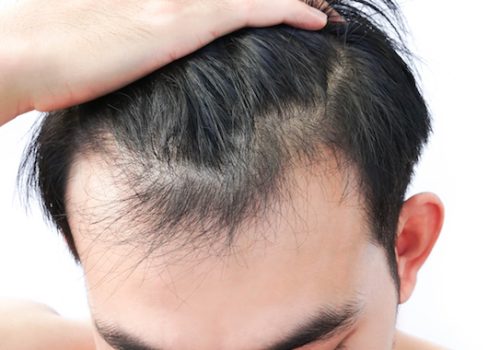 Best hair Specialist in Lahore, hair clinic in lahore, doctor for hair loss, best treatment for hair loss